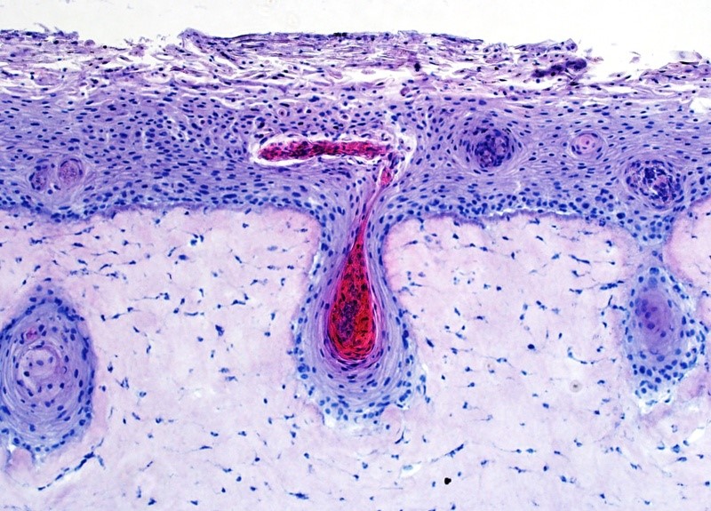 Grupo Boticário anuncia projeto de Pele 3D com Folículo Capilar